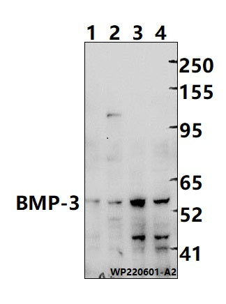 Western blot (WB) analysis of BMP-3 (E306) polyclonal antibody at 1:1000 dilution
Lane1:CT26 whole cell lysate(30ug)
Lane2:PC12 whole cell lysate(30ug)
Lane3:HepG2 whole cell lysate(30ug)
Lane4:A549 whole cell lysate(30ug