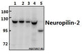 Western blot (WB) analysis of Neuropilin-2 (M373) pAb at 1:500 dilution
Lane1:PC3 whole cell lysate(40ug)
Lane2:HEK293T whole cell lysate(20ug)
Lane3:A549 whole cell lysate(20ug)
Lane4:PC12 whole cell lysate(40ug)
Lane5:The Kidney tissue lysate of Mouse(40ug)