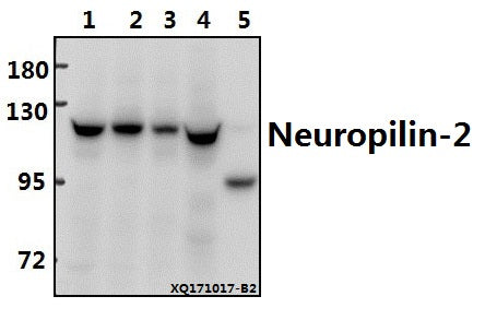 Western blot (WB) analysis of Neuropilin-2 (M373) pAb at 1:500 dilution
Lane1:PC3 whole cell lysate(40ug)
Lane2:HEK293T whole cell lysate(20ug)
Lane3:A549 whole cell lysate(20ug)
Lane4:PC12 whole cell lysate(40ug)
Lane5:The Kidney tissue lysate of Mouse(40ug)