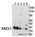 Western blot (WB) analysis of ASCL1 (E158) polyclonal antibody at 1:1000 dilution
Lane1:The brain tissue lysate of mouse(30ug)
Lane2:The brain tissue lysate of Rat(30ug)
Lane3:K562 whole cell lysate(30ug)
Lane4:BV2 whole cell lysate(30ug)
Lane5:A2780 cell membrane lysate(30ug)