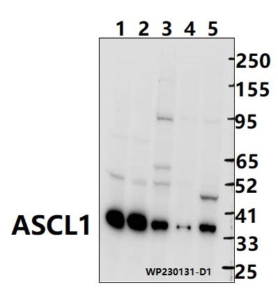 Western blot (WB) analysis of ASCL1 (E158) polyclonal antibody at 1:1000 dilution
Lane1:The brain tissue lysate of mouse(30ug)
Lane2:The brain tissue lysate of Rat(30ug)
Lane3:K562 whole cell lysate(30ug)
Lane4:BV2 whole cell lysate(30ug)
Lane5:A2780 cell membrane lysate(30ug)
