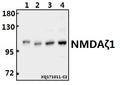Western blot (WB) analysis of NMDAζ1 (F891) pAb at 1:500 dilution
Lane1:MCF-7 whole cell lysate(20ug)
Lane2:Hela whole cell lysate(40ug)
Lane3:PMVEC whole cell lysate(40ug)
Lane4:AML-12 whole cell lysate(40ug)
