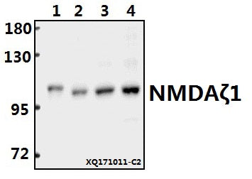 Western blot (WB) analysis of NMDAζ1 (F891) pAb at 1:500 dilution
Lane1:MCF-7 whole cell lysate(20ug)
Lane2:Hela whole cell lysate(40ug)
Lane3:PMVEC whole cell lysate(40ug)
Lane4:AML-12 whole cell lysate(40ug)