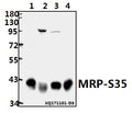 Western blot (WB) analysis of MRP-S35 (I252) pAb at 1:500 dilution
Lane1:HEK293T whole cell lysate(40ug)
Lane2:PC3 whole cell lysate(40ug)
Lane3:A549 whole cell lysate(40ug)
Lane4:K562 whole cell lysate(40ug)