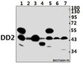 Western blot (WB) analysis of DD2 (Q60) pAb at 1:500 dilution
Lane1:PC12 whole cell lysate(40ug)
Lane2:AML-12 whole cell lysate(40ug)
Lane3:HEK293T whole cell lysate(40ug)
Lane4:K562 whole cell lysate(40ug)
Lane5:Hela whole cell lysate(40ug)
Lane6:H1792 whole cell lysate(40ug)
Lane7:HepG2 whole cell lysate(40ug)