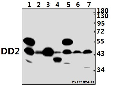 Western blot (WB) analysis of DD2 (Q60) pAb at 1:500 dilution
Lane1:PC12 whole cell lysate(40ug)
Lane2:AML-12 whole cell lysate(40ug)
Lane3:HEK293T whole cell lysate(40ug)
Lane4:K562 whole cell lysate(40ug)
Lane5:Hela whole cell lysate(40ug)
Lane6:H1792 whole cell lysate(40ug)
Lane7:HepG2 whole cell lysate(40ug)