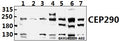 Western blot (WB) analysis of CEP290 (F812) polyclonal antibody at 1:500 dilution
Lane1:HCT116 whole cell lysate(40ug)
Lane2:SGC7901 whole cell lysate(40ug)
Lane3:COS-7 whole cell lysate(40ug)
Lane4:A549 whole cell lysate(40ug)
Lane5:CT26 whole cell lysate(40ug)
Lane6:AML-12 whole cell lysate(40ug)
Lane7:PC12 whole cell lysate(40ug)