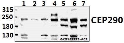 Western blot (WB) analysis of CEP290 (F812) polyclonal antibody at 1:500 dilution
Lane1:HCT116 whole cell lysate(40ug)
Lane2:SGC7901 whole cell lysate(40ug)
Lane3:COS-7 whole cell lysate(40ug)
Lane4:A549 whole cell lysate(40ug)
Lane5:CT26 whole cell lysate(40ug)
Lane6:AML-12 whole cell lysate(40ug)
Lane7:PC12 whole cell lysate(40ug)