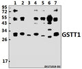 Western blot (WB) analysis of GSTT1 (R31) pAb at 1:500 dilution
Lane1:H1792 whole cell lysate(40ug)
Lane2:K562 whole cell lysate(40ug)
Lane3:HCC827 whole cell lysate(40ug)
Lane4:Jurkat whole cell lysate(40ug)
Lane5:H9C2 whole cell lysate(40ug)
Lane6:AML-12 whole cell lysate(40ug)
Lane7:HepG2 whole cell lysate(40ug)