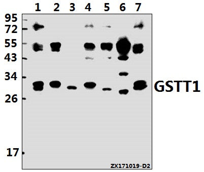 Western blot (WB) analysis of GSTT1 (R31) pAb at 1:500 dilution
Lane1:H1792 whole cell lysate(40ug)
Lane2:K562 whole cell lysate(40ug)
Lane3:HCC827 whole cell lysate(40ug)
Lane4:Jurkat whole cell lysate(40ug)
Lane5:H9C2 whole cell lysate(40ug)
Lane6:AML-12 whole cell lysate(40ug)
Lane7:HepG2 whole cell lysate(40ug)