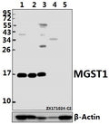 Western blot (WB) analysis of MGST1 (R74) pAb at 1:1000 dilution
Lane1:HepG2 whole cell lysate(20ug)
Lane2:HCC827 whole cell lysate(10ug)
Lane3:The Liver tissue lysate of Rat(40ug)
Lane4:The Liver tissue lysate of Mouse(40ug)
Lane5:3T3-L1 whole cell lysate(40ug)