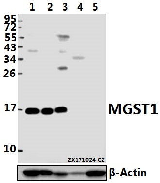 Western blot (WB) analysis of MGST1 (R74) pAb at 1:1000 dilution
Lane1:HepG2 whole cell lysate(20ug)
Lane2:HCC827 whole cell lysate(10ug)
Lane3:The Liver tissue lysate of Rat(40ug)
Lane4:The Liver tissue lysate of Mouse(40ug)
Lane5:3T3-L1 whole cell lysate(40ug)