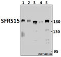 Western blot (WB) analysis of SFRS15 (V641) pAb at 1:1000 dilution
Lane1:C6 whole cell lysate(40ug)
Lane2:CT26 whole cell lysate(40ug)
Lane3:HCT116 whole cell lysate(40ug)
Lane4:SGC7901 whole cell lysate(40ug)
Lane5:HEK293T whole cell lysate(20ug)