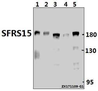 Western blot (WB) analysis of SFRS15 (V641) pAb at 1:1000 dilution
Lane1:C6 whole cell lysate(40ug)
Lane2:CT26 whole cell lysate(40ug)
Lane3:HCT116 whole cell lysate(40ug)
Lane4:SGC7901 whole cell lysate(40ug)
Lane5:HEK293T whole cell lysate(20ug)