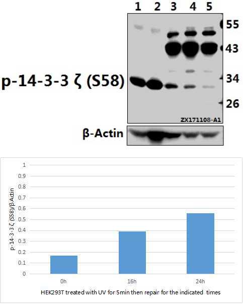 Western blot (WB) analysis of 14-3-3 ζ (phospho-S58) polyclonal antibody at 1:500 dilution
Lane1:The Brain tissue lysate of Mouse(40ug)
Lane2:The Brain tissue lysate of Rat(40ug)
Lane3:HEK293T treated with UV for 5 minutes then repair for 24 hours whole cell lysate(40ug)
Lane4:HEK293T treated with UV for 5 minutes then repair for 16 hours whole cell lysate(40ug)
Lane5:HEK293T whole cell lysate(40ug)