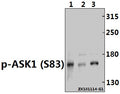 Western blot (WB) analysis of ASK1 (phospho-S83) polyclonal antibody at 1:500 dilution
Lane1:A549 whole cell lysate(40ug)
Lane2:Panc1 whole cell lysate(40ug)
Lane3:H1792 whole cell lysate(30ug)