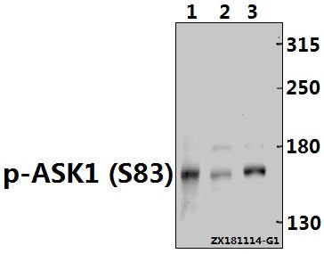 Western blot (WB) analysis of ASK1 (phospho-S83) polyclonal antibody at 1:500 dilution
Lane1:A549 whole cell lysate(40ug)
Lane2:Panc1 whole cell lysate(40ug)
Lane3:H1792 whole cell lysate(30ug)