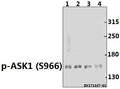Western blot (WB) analysis of p-ASK1 (S966) pAb at 1:500 dilution
Lane1:H1792 whole cell lysate(40ug)
Lane2:K562 whole cell lysate(40ug)
Lane3:MCF-7 whole cell lysate(40ug)
Lane4:HEK293T whole cell lysate(40ug)