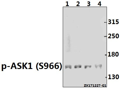 Western blot (WB) analysis of p-ASK1 (S966) pAb at 1:500 dilution
Lane1:H1792 whole cell lysate(40ug)
Lane2:K562 whole cell lysate(40ug)
Lane3:MCF-7 whole cell lysate(40ug)
Lane4:HEK293T whole cell lysate(40ug)