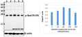 Western blot (WB) analysis of Bad (phospho-S136) polyclonal antibody at 1:500 dilution
Lane1:HEK293T whole cell lysate(40ug)
Lane2:HEK293T treated with UV for 1h whole cell lysate(40ug)
Lane3:HEK293T treated with UV for 4h whole cell lysate(40ug)
Lane4:HEK293T treated with UV for 16h whole cell lysate(40ug)
Lane5:HEK293T treated with UV for 24h whole cell lysate(40ug)