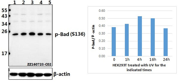Western blot (WB) analysis of Bad (phospho-S136) polyclonal antibody at 1:500 dilution
Lane1:HEK293T whole cell lysate(40ug)
Lane2:HEK293T treated with UV for 1h whole cell lysate(40ug)
Lane3:HEK293T treated with UV for 4h whole cell lysate(40ug)
Lane4:HEK293T treated with UV for 16h whole cell lysate(40ug)
Lane5:HEK293T treated with UV for 24h whole cell lysate(40ug)