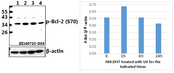 Western blot (WB) analysis of Bcl-2 (phospho-S70) polyclonal antibody at 1:500 dilution
Lane1:HEK293T whole cell lysate(40ug)
Lane2:HEK293T treated with UV for 1h whole cell lysate(40ug)
Lane3:HEK293T treated with UV for 6h whole cell lysate(40ug)
Lane4:HEK293T treated with UV for 24h whole cell lysate(40ug)