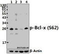 Western blot (WB) analysis of Bcl-X (phospho-S62) polyclonal antibody at 1:500 dilution
Lane1:HepG2 whole cell lysate(40ug)
Lane2:HEK293T whole cell lysate(40ug)
Lane3:The Brain tissue lysate of Mouse(40ug)
Lane4:The Brain tissue lysate of Rat(40ug)