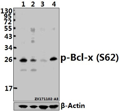 Western blot (WB) analysis of Bcl-X (phospho-S62) polyclonal antibody at 1:500 dilution
Lane1:HepG2 whole cell lysate(40ug)
Lane2:HEK293T whole cell lysate(40ug)
Lane3:The Brain tissue lysate of Mouse(40ug)
Lane4:The Brain tissue lysate of Rat(40ug)