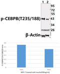 Western blot (WB) analysis of C/EBP-β (phospho-T235/188) pAb at 1:500 dilution
Lane1:MCF-7 treated with insulin(500ng/ml,5min) whole cell lysate(40ug)
Lane2:MCF-7 treated with insulin(500ng/ml,0min) whole cell lysate (40ug)