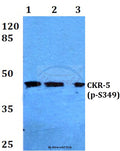 Western blot (WB) analysis of p-CKR-5 (S349) polyclonal antibody at 1:500 dilution
Lane1:Hela cell lysate treated with PMA(100nM,15mins)
Lane2:sp2/0 cell lysate treated with PMA(100nM,15mins)
Lane3:PC12 cell lysate treated with PMA(100nM,15mins)