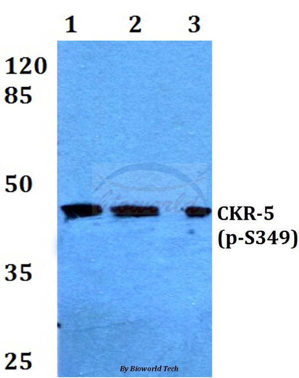 Western blot (WB) analysis of p-CKR-5 (S349) polyclonal antibody at 1:500 dilution
Lane1:Hela cell lysate treated with PMA(100nM,15mins)
Lane2:sp2/0 cell lysate treated with PMA(100nM,15mins)
Lane3:PC12 cell lysate treated with PMA(100nM,15mins)