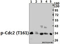 Western blot (WB) analysis of Cdk1/Cdc2 (phospho-T161) polyclonal antibody at 1:500 dilution
Lane1:PC12 whole cell lysate(40ug)
Lane2:3T3-L1 whole cell lysate(40ug)
Lane3:HEK293T whole cell lysate(40ug)
Lane4:MCF-7 whole cell lysate(40ug)
Lane5:PC3 whole cell lysate(40ug)