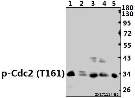Western blot (WB) analysis of Cdk1/Cdc2 (phospho-T161) polyclonal antibody at 1:500 dilution
Lane1:PC12 whole cell lysate(40ug)
Lane2:3T3-L1 whole cell lysate(40ug)
Lane3:HEK293T whole cell lysate(40ug)
Lane4:MCF-7 whole cell lysate(40ug)
Lane5:PC3 whole cell lysate(40ug)