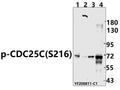 Western blot (WB) analysis of p-CDC25C(S216) pAb at 1:500 dilution
Lane1:PC12 whole cell lysate(40ug)
Lane2:CT-26 whole cell lysate(40ug)
Lane3:Hela whole cell lysate(40ug)
Lane4:HEK293T whole cell lysate(40ug)