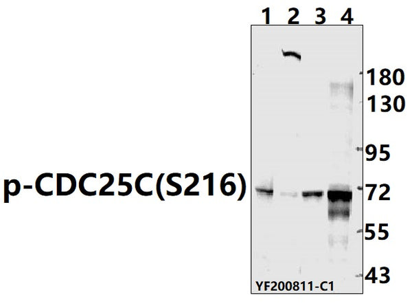 Western blot (WB) analysis of p-CDC25C(S216) pAb at 1:500 dilution
Lane1:PC12 whole cell lysate(40ug)
Lane2:CT-26 whole cell lysate(40ug)
Lane3:Hela whole cell lysate(40ug)
Lane4:HEK293T whole cell lysate(40ug)
