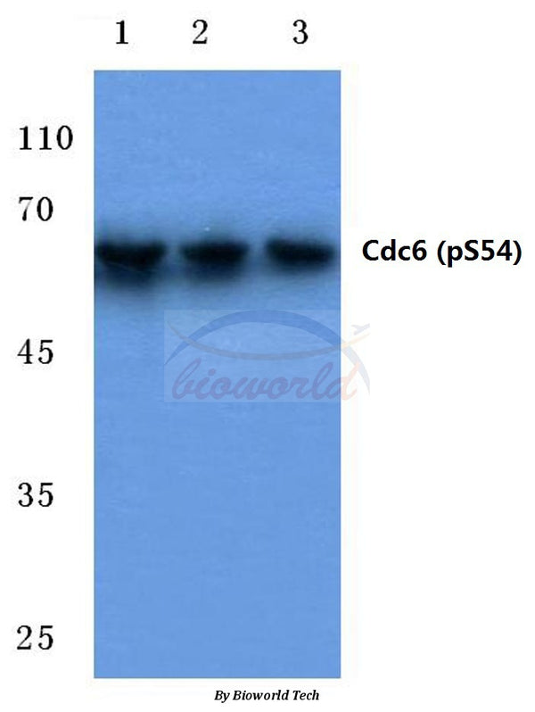 Western blot (WB) analysis of p-Cdc6 (S54) polyclonal antibody at 1:500 dilution
Lane1:Hela cell lysate treated with serum starvation
Lane2:Raw264.7 cell lysate treated with serum starvation
Lane3:H9C2 cell lysate treated with serum starvation