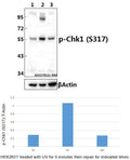 Western blot (WB) analysis of Chk1 (phospho-S317) polyclonal antibody at 1:500 dilution
Lane1:HEK293T  whole cell lysate
Lane2:HEK293T treated with UV for 5 minutes then repair for 4 hours whole cell lysate
Lane3:HEK293T treated with UV for 5 minutes then repair for 16 hours whole cell lysate