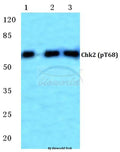 Western blot (WB) analysis of p-Chk2 (T68) polyclonal antibody at 1:500 dilution
Lane1:MCF-7 cell lysate treated with UV
Lane2:Mouse kidney tissue lysate
Lane3:H9C2 cell lysate treated with UV