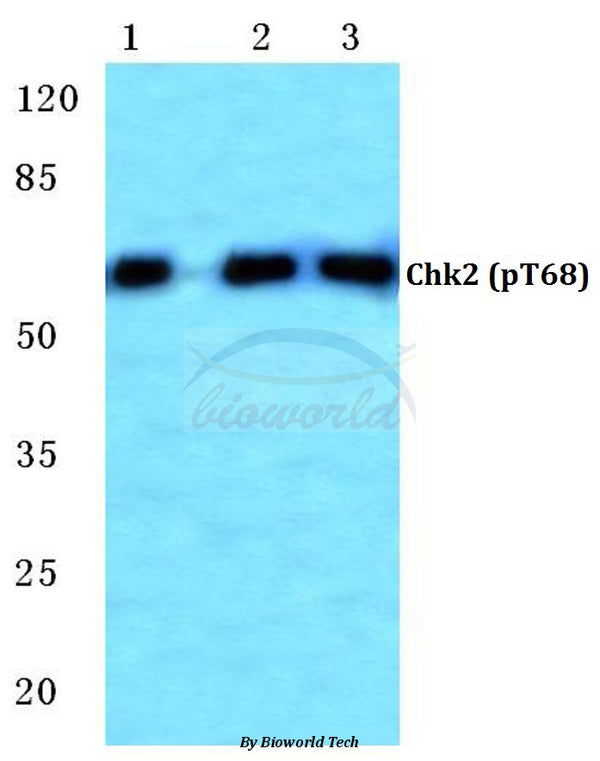 Western blot (WB) analysis of p-Chk2 (T68) polyclonal antibody at 1:500 dilution
Lane1:MCF-7 cell lysate treated with UV
Lane2:Mouse kidney tissue lysate
Lane3:H9C2 cell lysate treated with UV