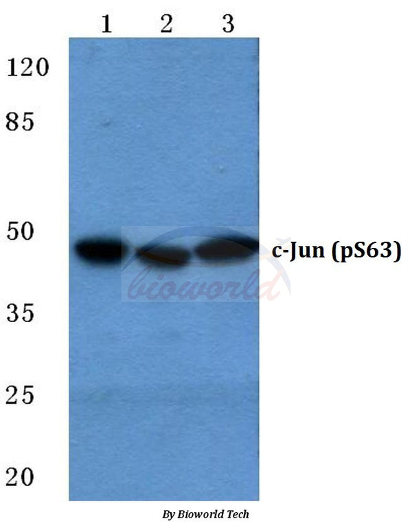 c-Jun (Phospho-S63) polyclonal antibody – Figure 1 of 1