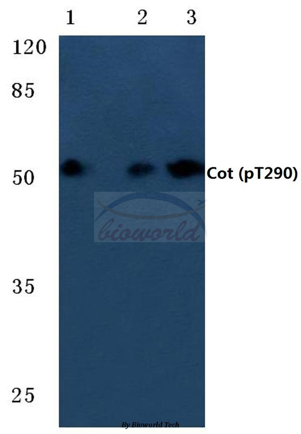 Cot (Phospho-T290) polyclonal antibody – Figure 1 of 1