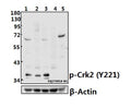 Western blot (WB) analysis of Crk2 (phospho-Y221) pAb at 1:500 dilution
Lane1:A549 whole cell lysate(40ug)
Lane2:Hela whole cell lysate(40ug)
Lane3:MCF-7 whole cell lysate(40ug)
Lane4:The Kidney tissue lysate of Rat(40ug)
Lane5:The Kidney tissue lysate of Mouse(40ug)