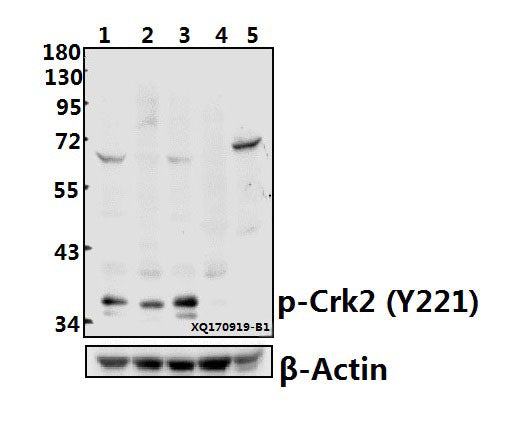 Western blot (WB) analysis of Crk2 (phospho-Y221) pAb at 1:500 dilution
Lane1:A549 whole cell lysate(40ug)
Lane2:Hela whole cell lysate(40ug)
Lane3:MCF-7 whole cell lysate(40ug)
Lane4:The Kidney tissue lysate of Rat(40ug)
Lane5:The Kidney tissue lysate of Mouse(40ug)