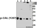 Western blot (WB) analysis of p-CrkL (Y207) pAb at 1:500 dilution
Lane1:MCF-7 whole cell lysate(40ug)
Lane2:HEK293T whole cell lysate(40ug)
Lane3:PMVEC whole cell lysate(40ug)
Lane4:CT26 whole cell lysate(40ug)
Lane5:SGC7901 whole cell lysate(40ug)