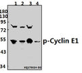 Western blot (WB) analysis of p-Cyclin E1 (T395) pAb at 1:500 dilution
Lane1:A549 whole cell lysate(40ug)
Lane2:HepG2 whole cell lysate(40ug)
Lane3:C6 whole cell lysate(40ug)
Lane4:BV2 whole cell lysate(40ug)