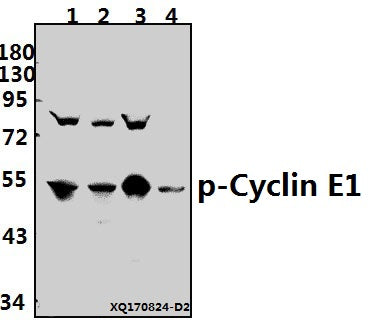 Western blot (WB) analysis of p-Cyclin E1 (T395) pAb at 1:500 dilution
Lane1:A549 whole cell lysate(40ug)
Lane2:HepG2 whole cell lysate(40ug)
Lane3:C6 whole cell lysate(40ug)
Lane4:BV2 whole cell lysate(40ug)