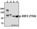 Western blot (WB) analysis of p-EEF2 (T56) pAb at 1:500 dilution
Lane1:K562 whole cell lysate(40ug)
Lane2:HEK293T whole cell lysate(10ug)
Lane3:The Liver tissue lysate of Rat(40ug)
Lane4:The Liver tissue lysate of Mouse(40ug)
