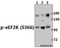 Western blot (WB) analysis of p-eEF2K (S366) pAb at 1:1000 dilution
Lane1:MCF-7 whole cell lysate(40ug)
Lane2:Hela whole cell lysate(40ug)
Lane3:A375 whole cell lysate(40ug)