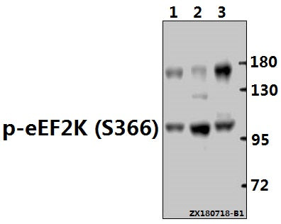Western blot (WB) analysis of p-eEF2K (S366) pAb at 1:1000 dilution
Lane1:MCF-7 whole cell lysate(40ug)
Lane2:Hela whole cell lysate(40ug)
Lane3:A375 whole cell lysate(40ug)
