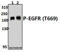 Western blot (WB) analysis of EGFR (phospho-T669) polyclonal antibody at 1:500 dilution
Lane1:HCC827 whole cell lysate(20ug)
Lane2:A549 whole cell lysate(40ug)